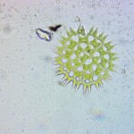 Pediastrum duplex observed by Lena Struwe.